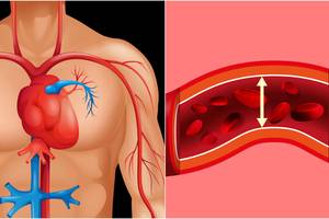 Įsidėmėkite: šie būdai kraujospūdį padės sumažinti be vaistų