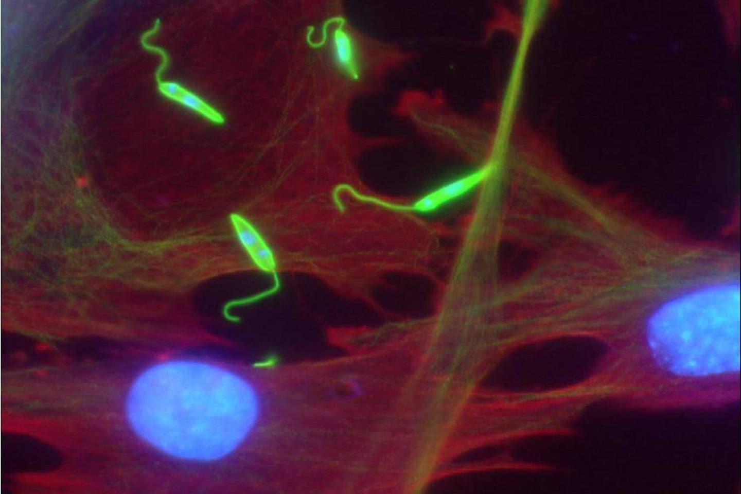 Leishmania major (žalia spalva) šeimininko ląstelėse (raudona spalva žymi citoplazmą, mėlyna – branduolius).<br>Geraldo Spätho ir Stepheno Beverley (Vašingtono universiteto Medicinos mokykla) nuotrauka