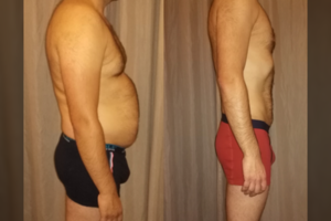 Vilnietis papasakojo, kaip jam iš pirmo karto pavyko numesti 23 kg