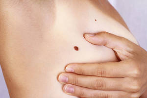 Teisinga prevencija užkerta kelią mirtinai ligai – ką reikia žinoti