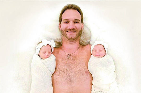 Be rankų ir kojų gimęs Nickas Vujičičius parodė savo dvynes