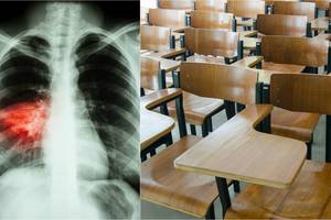 Gimnazistei diagnozavo pavojingą ligą, tiriamas infekcijos paplitimas mieste