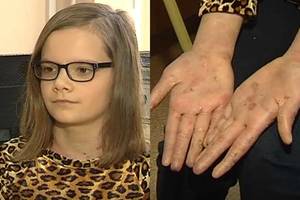 Šeima laukia stebuklo. Nepagydoma liga serganti Ramunė – vienintelė Europoje