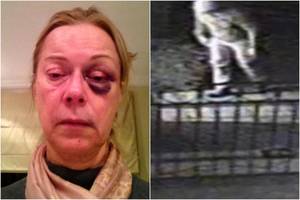 Turtuoliai britai dreba iš baimės: į juos nusitaikė smurtaujantis vagis