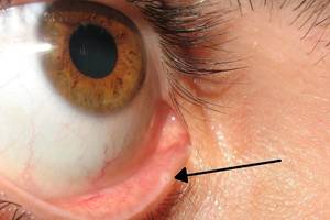 Šią skylutę akies voke turi visi. Štai kokią funkciją ji atlieka