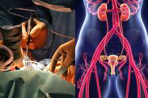 Įprasta operacija sugriovė moters gyvenimą: ligoninė kaltės kratosi