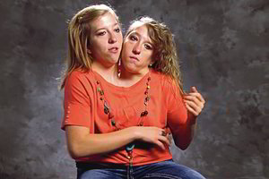 Mokytojos Siamo dvynės papasakojo, ko eiliniai žmonės neįsivaizduoja