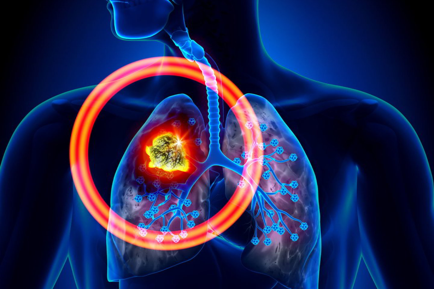  Plaučių vėžys bei širdies smūgis yra kone pavojingiausias šalutinis rūkymo poveikis.<br> 123rf.com nuotr.