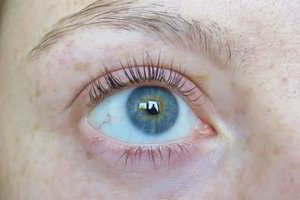 Slenka blakstienos? Gali būti, kad sergate viena iš šių ligų