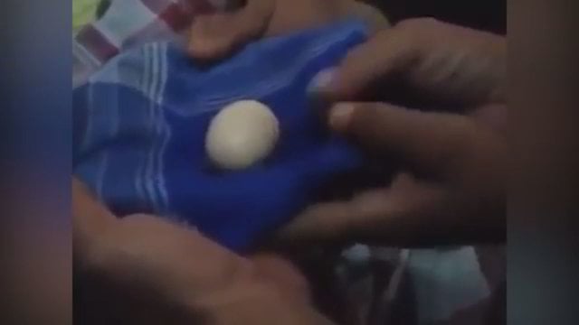 Medikai negali patikėti – ligoninėje atsidūrė kiaušinius dedantis berniukas
