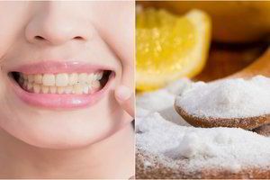 Pigu ir greita: vos vienas produktas ir dantys taps baltesni