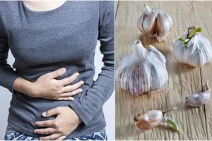 Nauda sveikatai nenuginčijama: tai sužinoję sudygusio česnako nebeišmesite