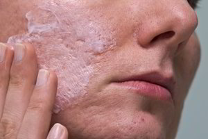 Pigus receptas, padėsiantis sutraukti dideles poras