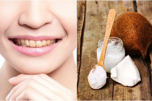 Vos du paprasti ingredientai ir jūsų šypsena taps akinančiai balta