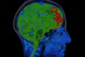 Nepagydoma liga gresia kiekvienam, bet yra būdų ją suvaldyti