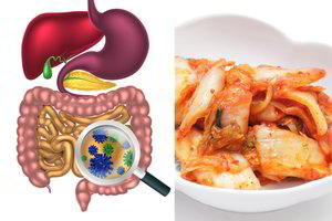 10 produktų, padėsiančių kamuojant žarnyno problemoms