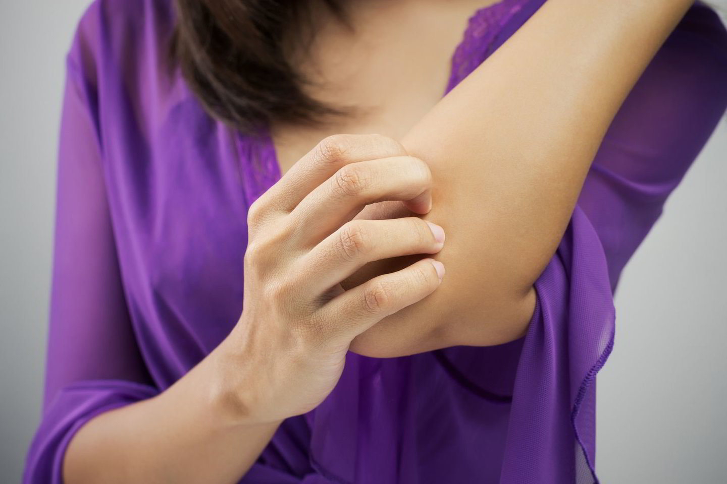   Niežtinti oda arba bėrimai gali būti autoimuninės ligos, pavyzdžiui, žvynelinės, požymis. <br>  123rf.com nuotr. 