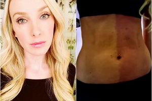 Moteris liko priblokšta sužinojusi, ką reiškia jos įgimta dėmė