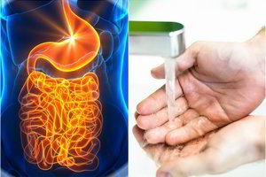 Medikai primena, kodėl svarbu maistą šventiniam stalui ruošti saugiai