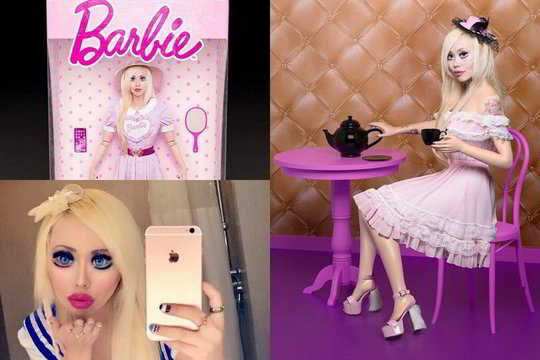 Gyva Barbė operacijoms išleido 49 000 eurų: mylimasis baiminasi dėl sveikatos