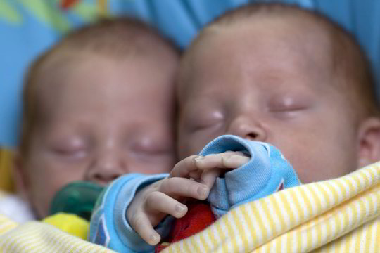 Siaubo istorija su laiminga pabaiga: stipriai sužalotos dvynukės gavo šansą