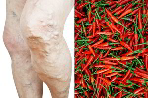 4 produktai, saugantys nuo išsiplėtusių venų