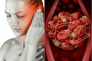 8 insulto požymiai: tai padės išgelbėti gyvybę