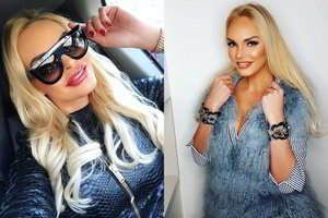 Vita Jakutienė darsyk pasitobulino lūpas ir atskleidė jų paslaptį