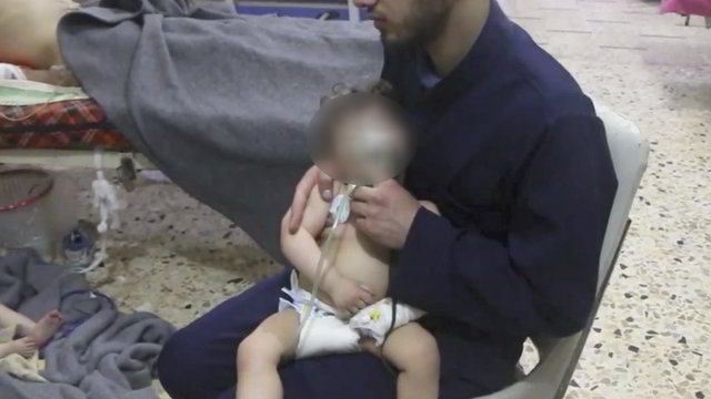 Cheminė ataka prieš civilius Sirijoje: rūsiuose – ištisos dujomis užtroškusios šeimos