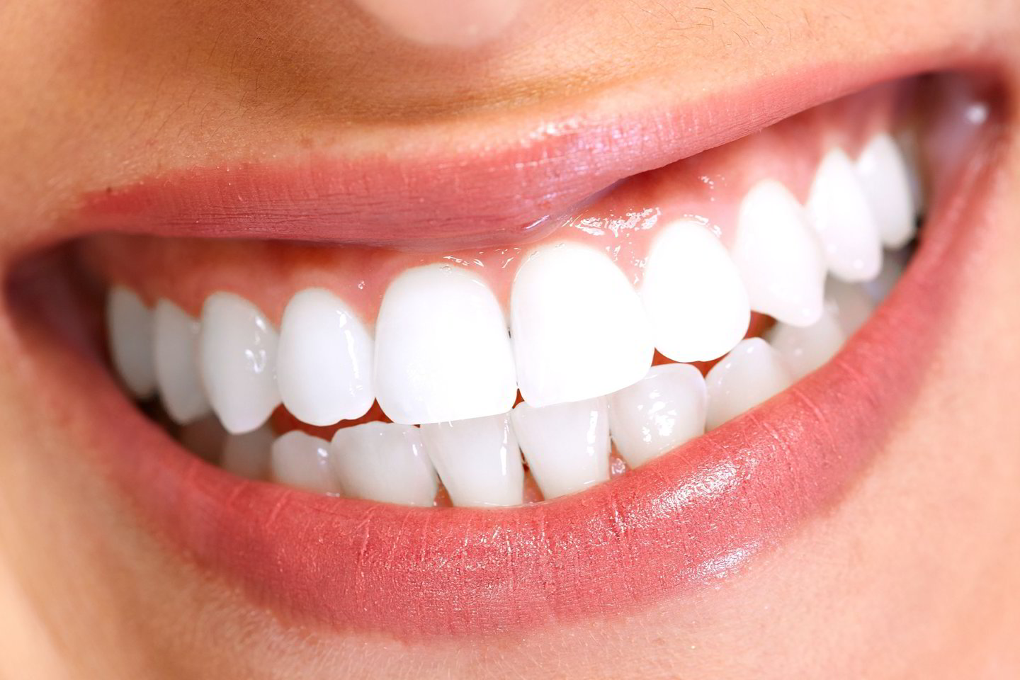  Turėti gražius dantis tapo visai paprasta.<br> 123rf nuotr.