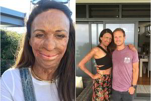 Siaubingą moters nelaimę užgožė išrinktojo rūpestis ir meilė