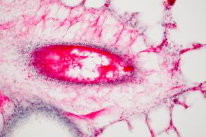 Daugiausia mirčių sukeliančio vėžio priežastys: kaip to išvengti