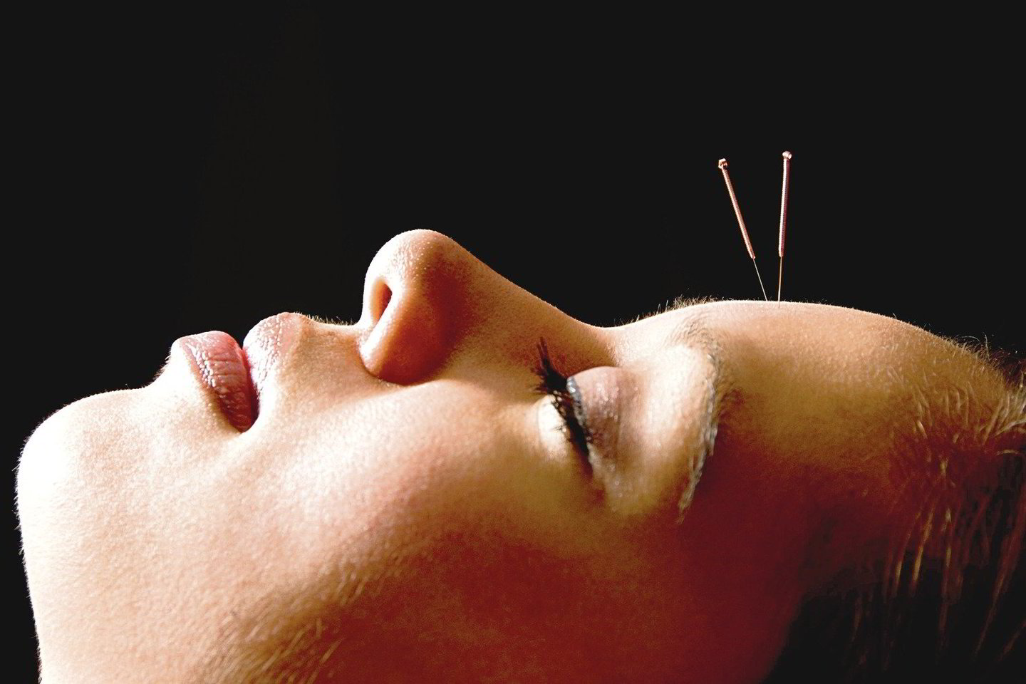 Pagal kinų mediciną akupunktūros metu adatėlės smaigstomos į taškus, esančius ant meridianų – po organizmą išsiraizgiusių energinių kanalų. <br>„123rf.com“ nuotr.