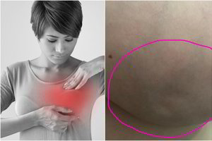 Ant krūties pastebėjo duobutes. To, ką patyrė, nelinkėtų ir priešui