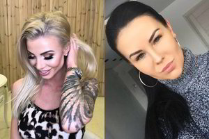 Marina Bui ir Indrė Burlinskaitė ryžosi skausmingai grožio procedūrai