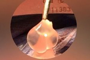 Nepatikėsite: išvydę, kas sukėlė moters galvos skausmus, gydytojai pakraupo