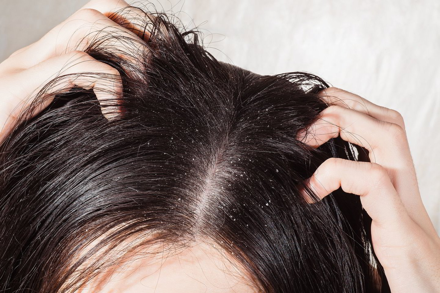  Netinkamai pasirinktas šampūnas sukelia ne tik galvos odos problemas, bet ir pažeidžia plaukus.<br> 123rf.com nuotr.