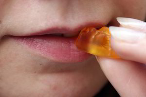 Iškilo pūslelė ant lūpos? 10 faktų apie herpeso virusą