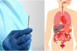 Ar kada susimąstėte? 7 organai, be kurių galite gyventi