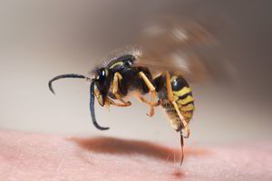 Vabzdžių įgėlimai: kada būtina vykti į ligoninę?