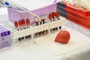 Kraujo centro byloje suimtas verslininkas paleistas į laisvę