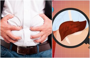 Darote viską, bet svoris nekrenta? Metas pasirūpinti vienu organu