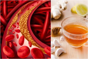 Pamirškite cholesterolį: vos 3 produktai, o nauda – didžiulė