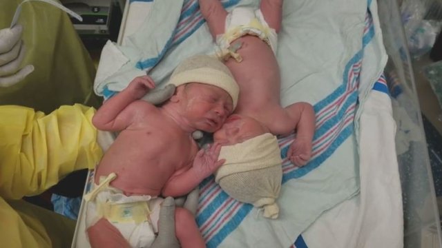 Neįkainojama ką tik gimusių dvynukų akimirka suvirpino tūkstančių širdis