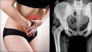 Pasitikrinkite: 8 dažnai ignoruojami požymiai įspėja apie mirtiną ligą