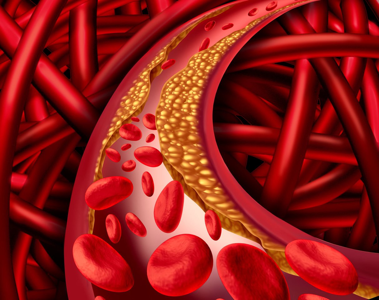  Širdies ir kraujagyslių ligos išlieka dažniausia mirties priežastimi.<br> 123rf.com nuotr.