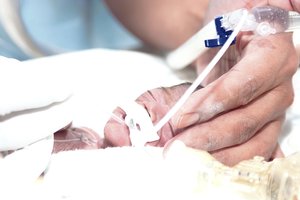 Medikai prabilo apie stebuklą: vaiką pagimdė komos ištikta motina