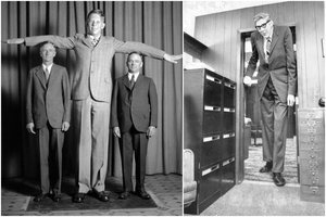 Neįtikėtini kadrai: štai kaip atrodė aukščiausias žmogus medicinos istorijoje