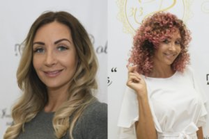 „TV pagalbos“ žvaigždės Gerdos Žemaitės išvaizdos pokyčiai pribloškia