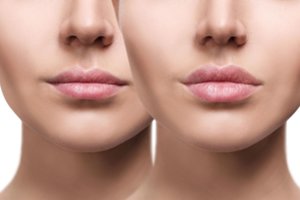 Paprasta it dukart du: tai padarius lūpos iškart taps putlesnės